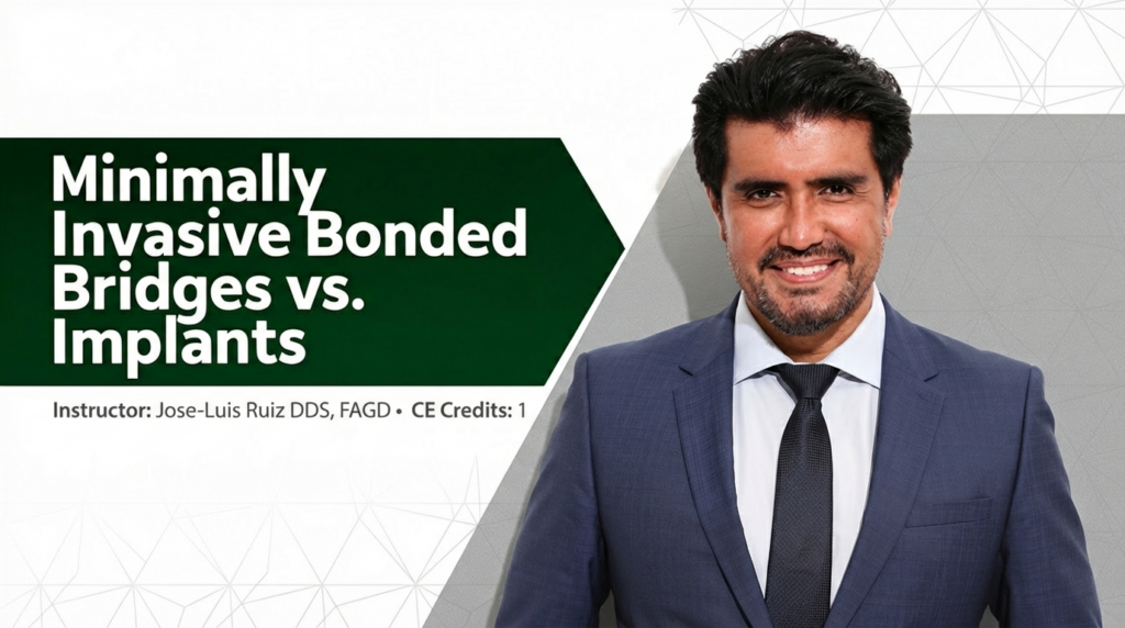 Minimally Invasive Bonded Bridges vs. Implants